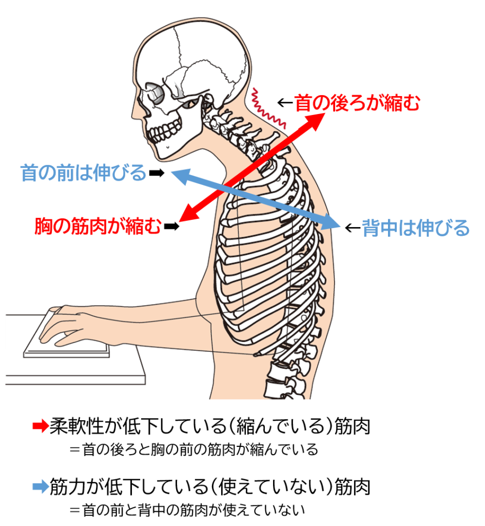 肩の力が抜けない人必見！正しく肩の力を抜く方法 | 鍼灸・接骨院 白澤堂HAKUTAKUDOU
