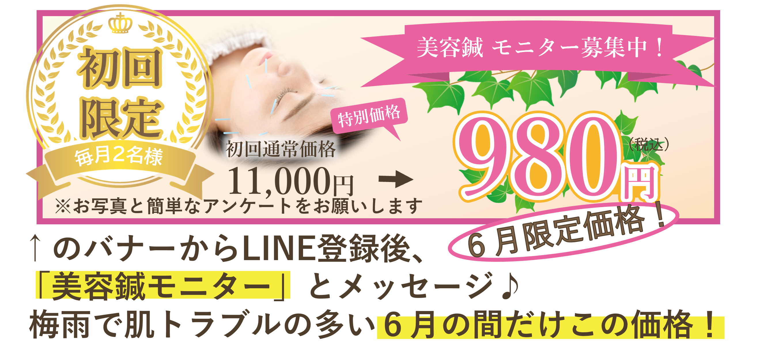 美容鍼モニター様募集のバナー6月限定価格